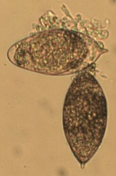 Aileens eggs